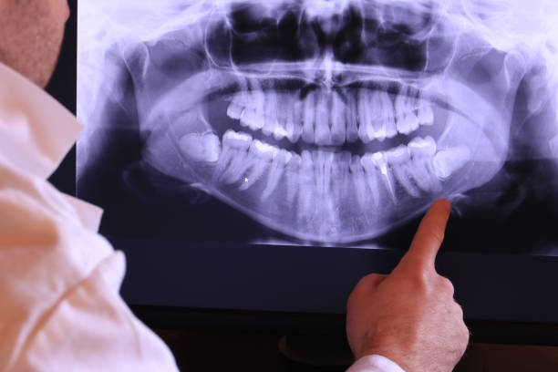 Best Emergency Treatment for Oral Infections in Abbeville, GA