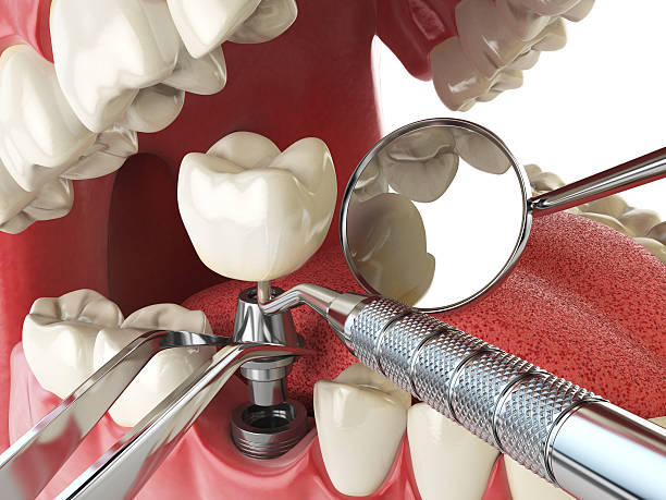 Best Emergency Cosmetic Dentistry (e.g., broken veneers) in Abbeville, GA