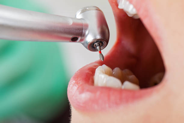 Reliable GA Emergency Dental Service Solutions